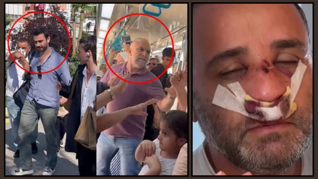 Maltepe’de “Mavi Gömlekli Çocuk” Sanıldı, Yanlış Kişiye Ateş Açıldı!